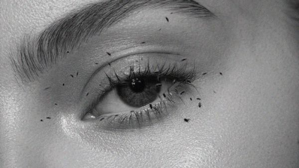 Irritated Eyes? You Might Have Mites in Them